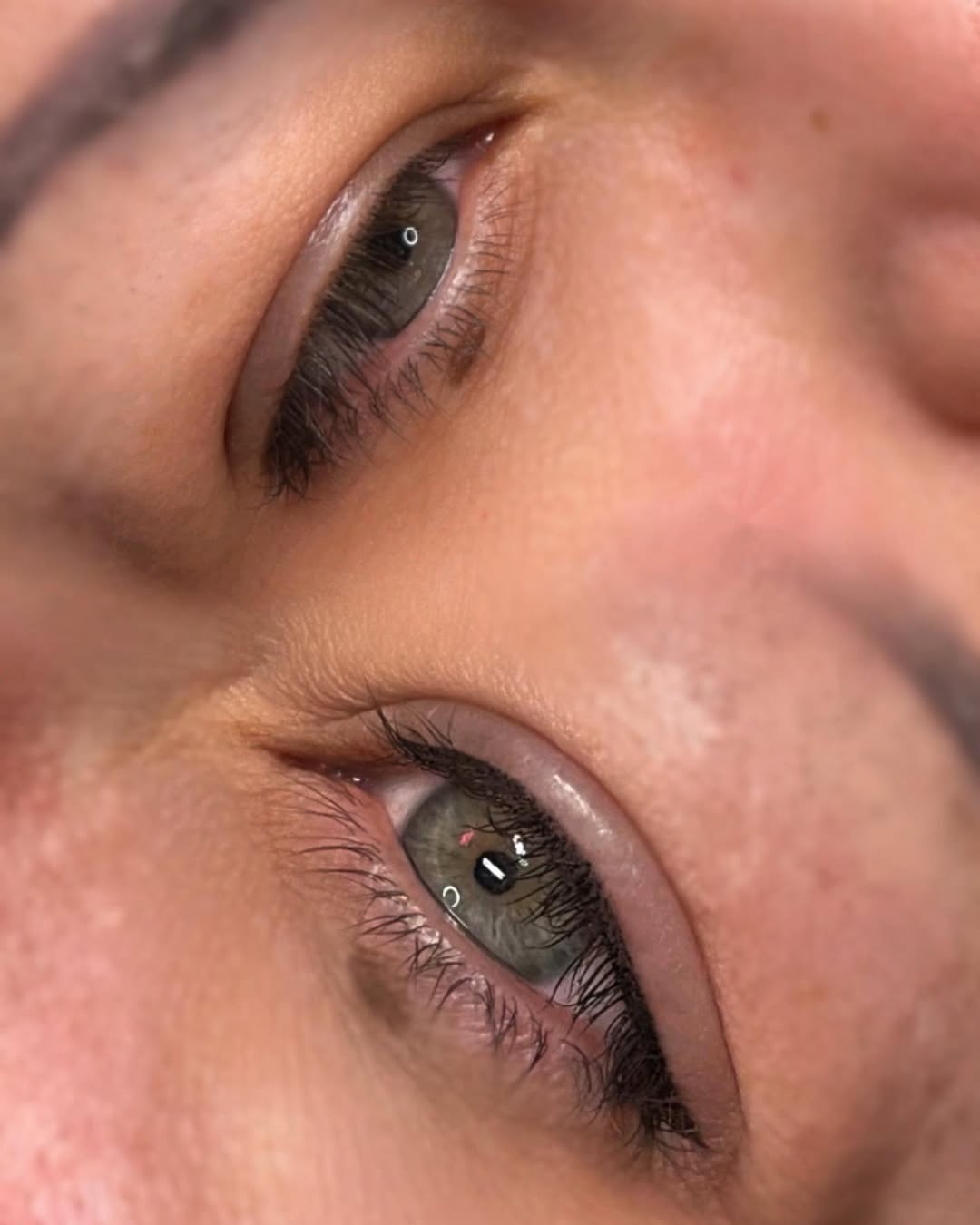 Lash line enhancement